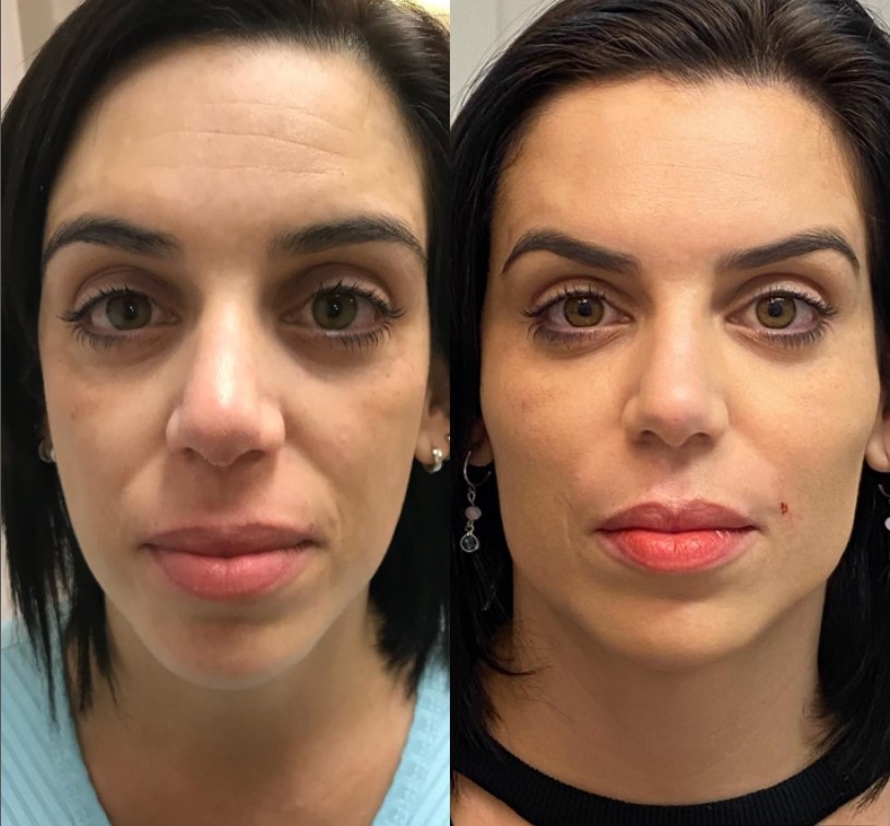 Antes e Depois dos nossos pacientes ⋆ Dra. Luana Rocha
